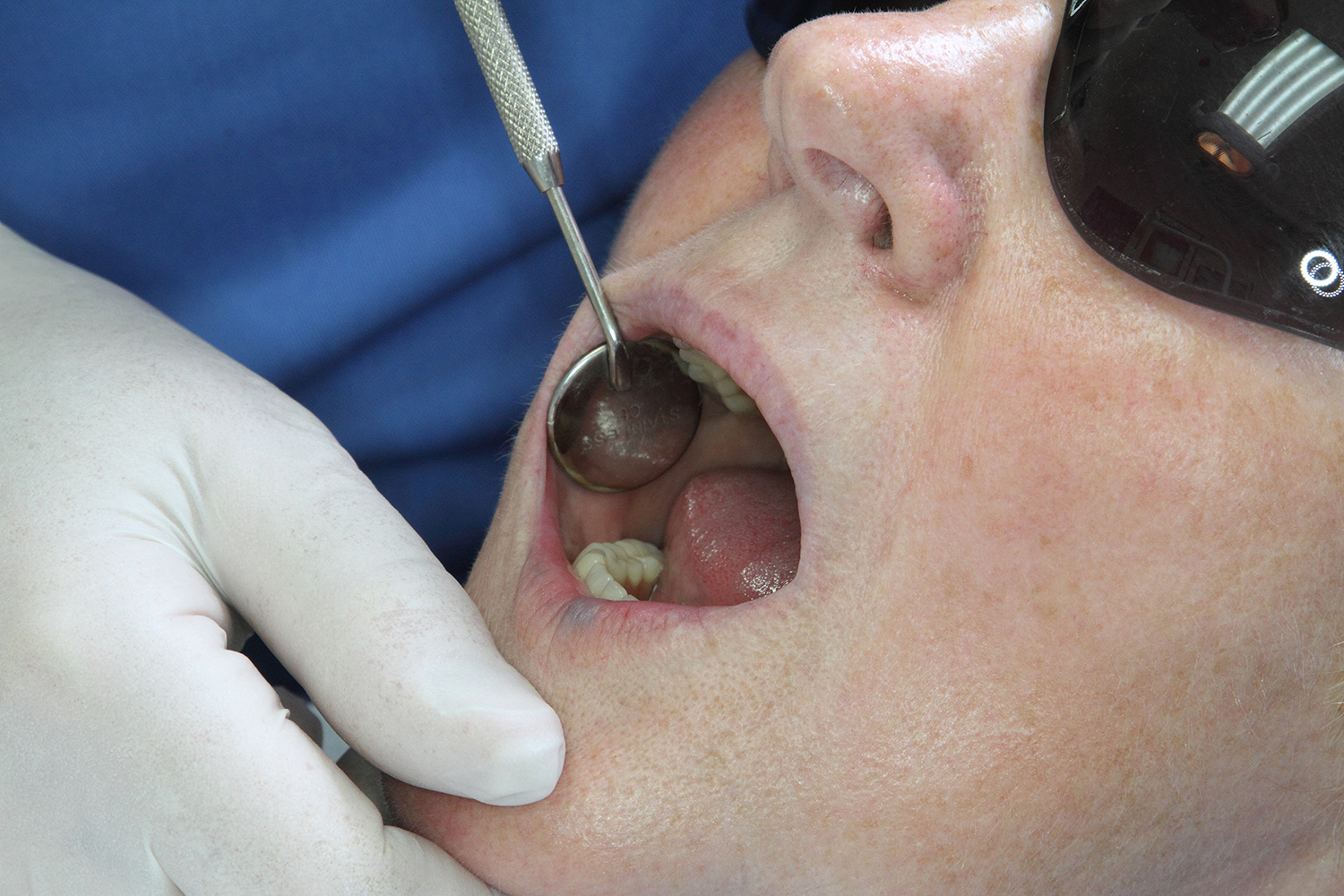 Dental Photography in Worcester.&nbsp; 